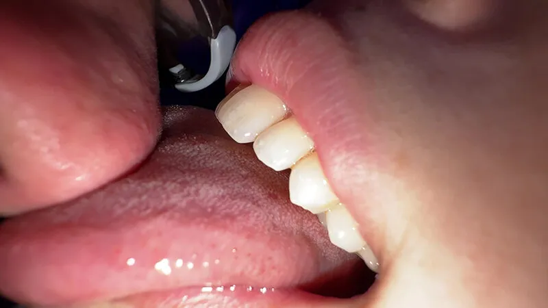 【個人撮影】横山夏希の肉厚舌ディープキス＆ツバ鼻吸い サンプル画像 10