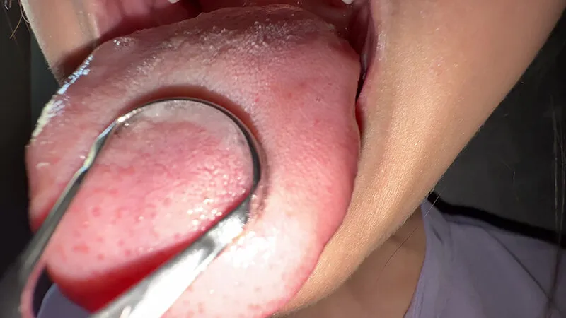【個人撮影】谷田かりなの舌ブラシで「汚舌苔」採取 サンプル画像 13