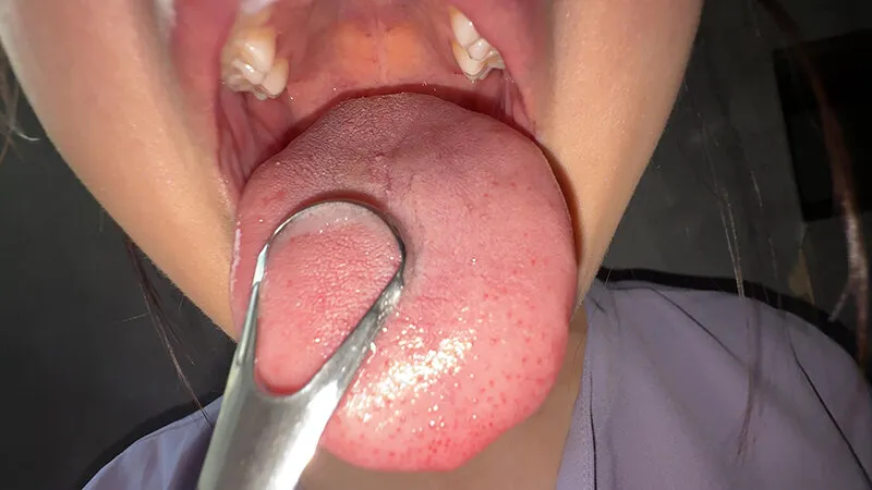 【個人撮影】谷田かりなの舌ブラシで「汚舌苔」採取 サンプル画像 14