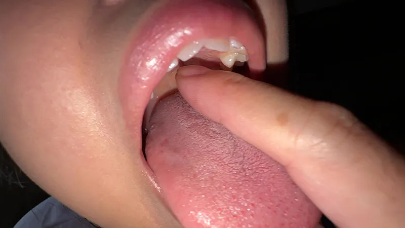 【個人撮影】谷田かりな 開口器で口内観察デカ舌を要チェック サンプル画像 12