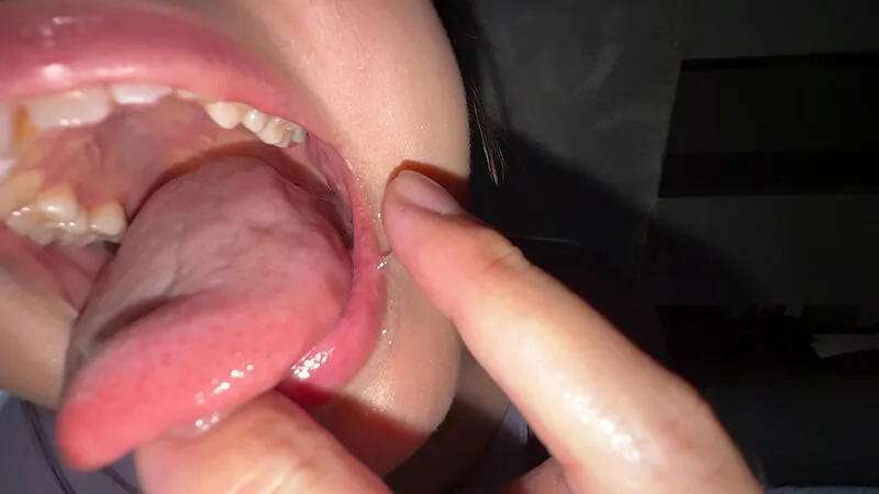 【個人撮影】谷田かりな 開口器で口内観察デカ舌を要チェック サンプル画像 17