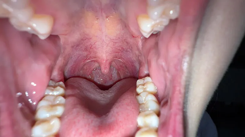 【個人撮影】谷田かりな 開口器で口内観察デカ舌を要チェック サンプル画像 3