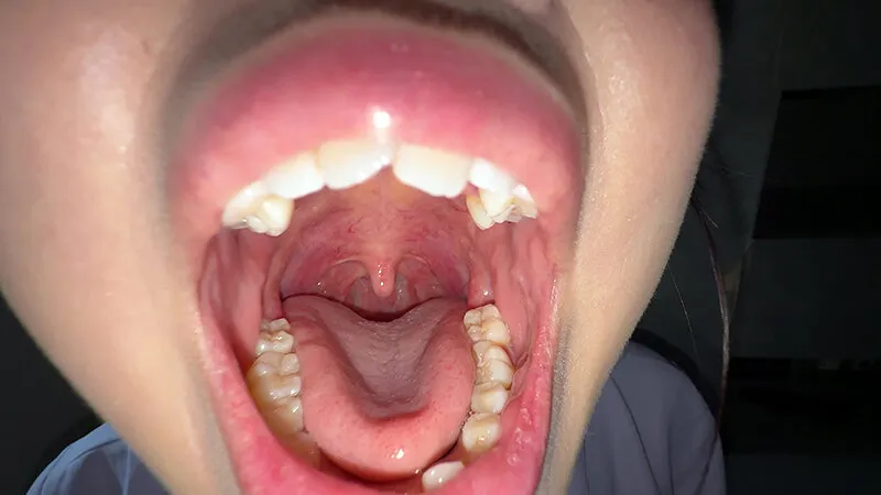 【個人撮影】谷田かりな 開口器で口内観察デカ舌を要チェック サンプル画像 4