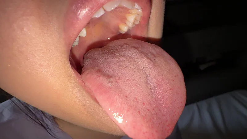 【個人撮影】谷田かりな 開口器で口内観察デカ舌を要チェック サンプル画像 8