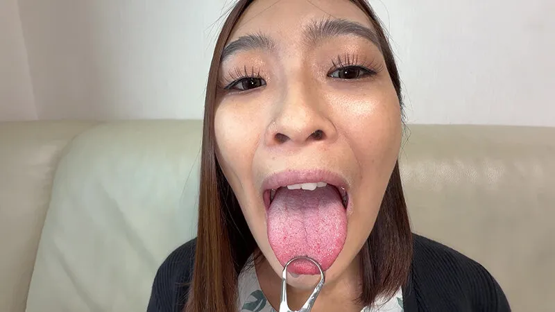 【個人撮影】旭メイサの舌ブラシで「汚舌苔」採取 サンプル画像 11