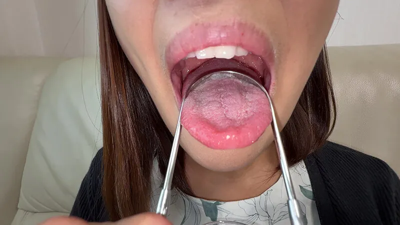 【個人撮影】旭メイサの舌ブラシで「汚舌苔」採取 サンプル画像 15