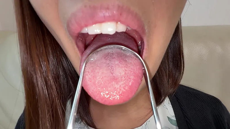 【個人撮影】旭メイサの舌ブラシで「汚舌苔」採取 サンプル画像 16