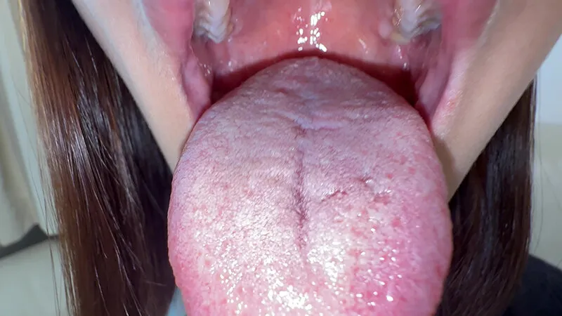 【個人撮影】旭メイサの舌ブラシで「汚舌苔」採取 サンプル画像 5
