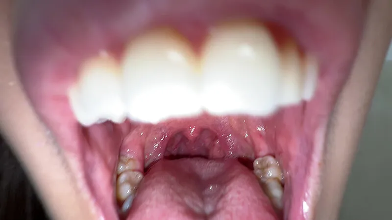 【個人撮影】旭メイサの喉チンコいじり サンプル画像 8