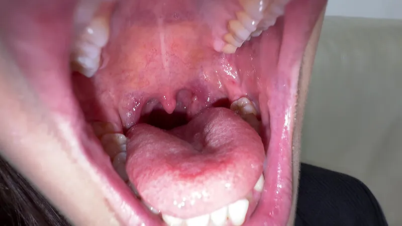 【個人撮影】旭メイサの喉チンコいじり サンプル画像 9