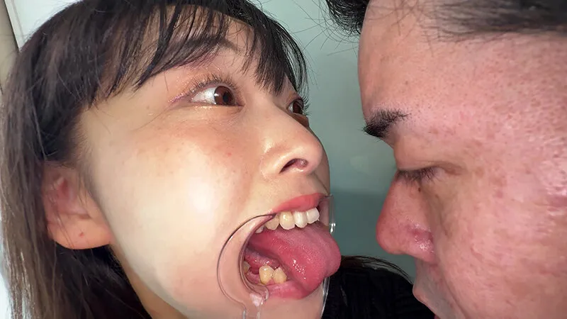【個人撮影】原美織の舌ブラシで「汚舌苔」採取 サンプル画像 20
