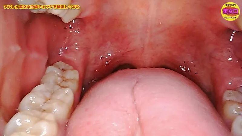 お口の中をじっくり見せてくれませんか？～アパレル店員はるのさん～ 安堂はるの サンプル画像 4