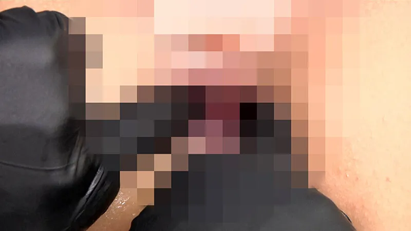 尻穴拡張クリニック 臨床手順に基づくアナル拡張記録 サンプル画像 12