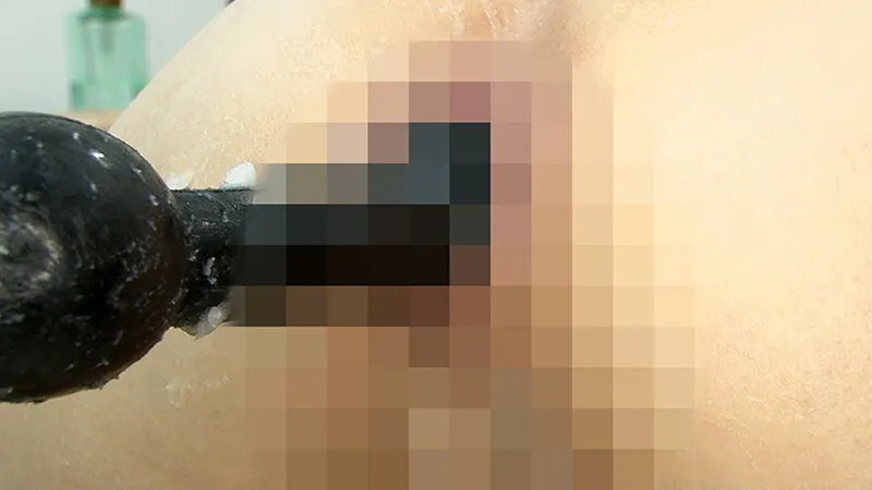 尻穴拡張クリニック 臨床手順に基づくアナル拡張記録 サンプル画像 19